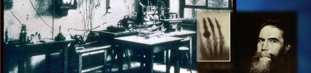 Roentgen 1895 Discovery of X -rays