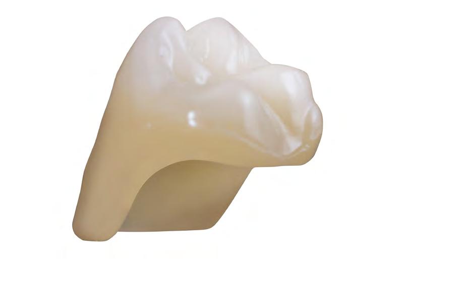 dentures  concepts Extra-wide tooth design,
