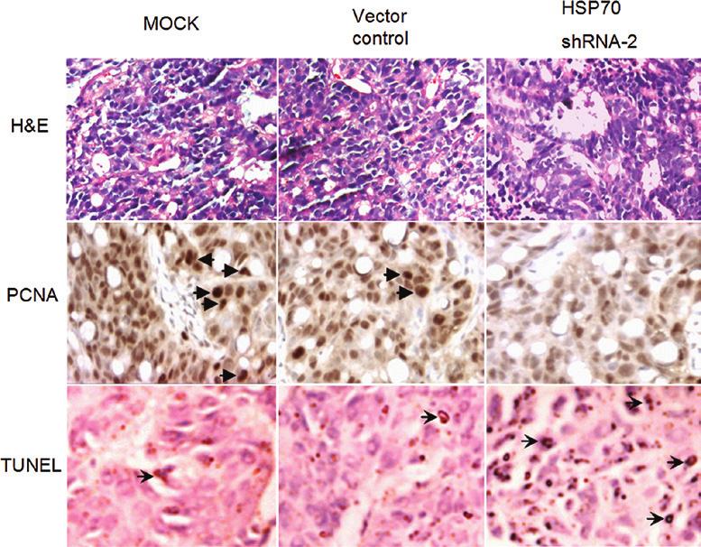 MOLECULAR MEDICINE REPORTS 4: 805-810, 2011 809 Figure 5. HSP70 shrna-2 group displayed suppression of colon cancer growth and enhancement of apoptosis in vivo.
