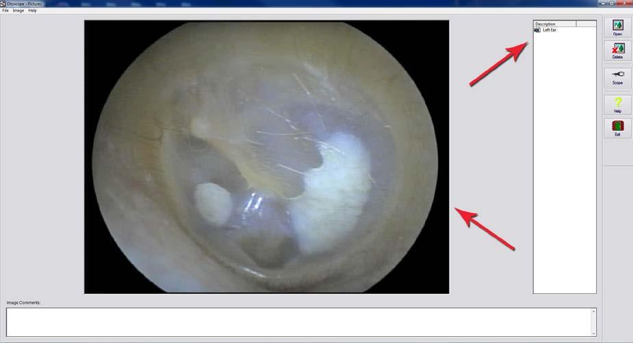 Using the Otoscope Software (Applies to all cameras) The Main Screen Within