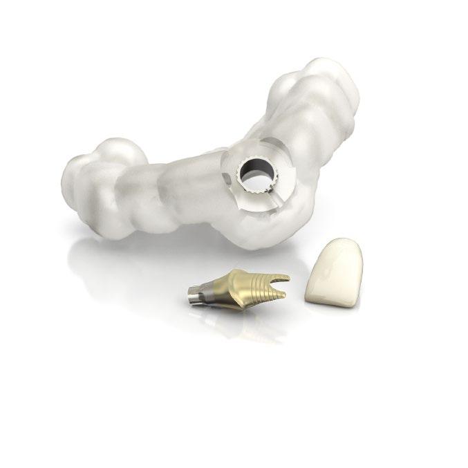 This solution consists of a SIMPLANT SAFE Guide, an ATLANTIS Abutment and a temporary crown based on the ATLANTIS Abutment Core File and is currently indicated for single-tooth implant restorations.