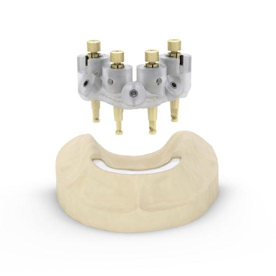 Replace the SIMPLANT SAFE Guide with the EV-PositioningAid and the connected implant replicas on the plaster cast and then check that there is no contact between the components and the cast.