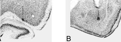 Fig. 1. Photomicrogrphs of histologicl sections showing the reconstruction of recording sites in representtive sujects in () nd (). The encompsses the oritl regions nd grnulr insulr cortex.