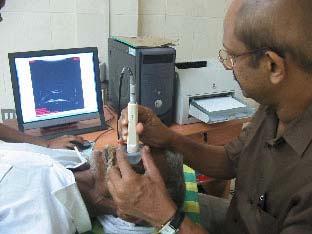 Ultrasound Biomicroscopy Noel Moniz, MS L.F. Hospital and Reserach Centre, Angamaly F O C U S The ultrasound biomicroscope works on the principle of an ultrasound but at a higher frequency.