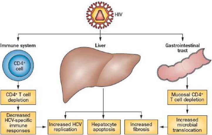 HCV Co-Infection in HIV+ MSM HIV CD4 Viral Load Multiple Partners Sexual Practices Other STDs SEX Crystal methamphet amines