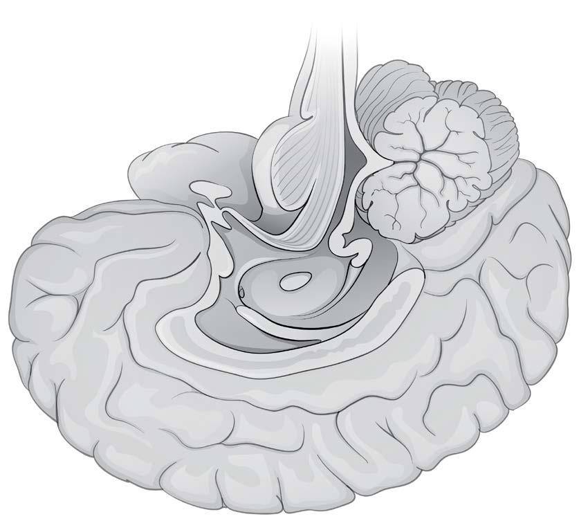 Monoamine Pathways Overlap in Several Areas of the Brain 1 8 PFC Substantia