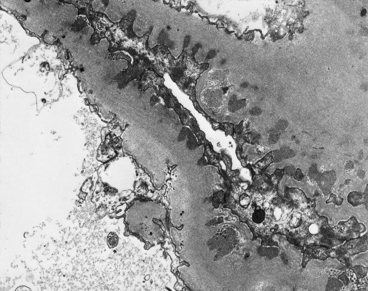 (Transmission electron micrograph; magnification 5,000.) Fig 6.
