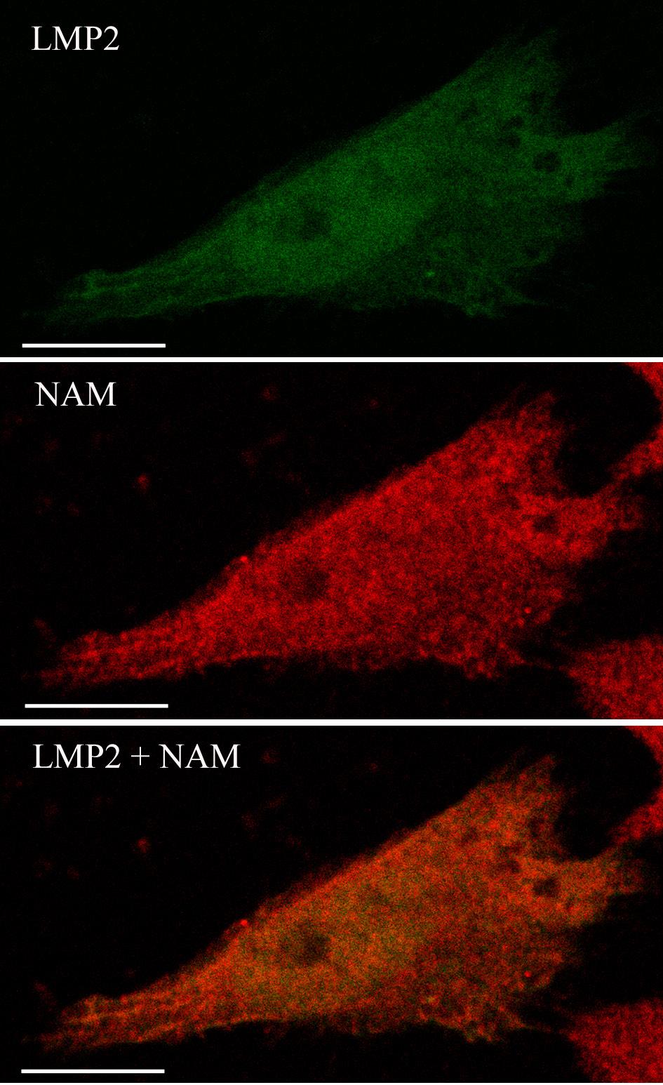 32 Summary of the Results Figure 3. Intracellular localisation of NAM in HeLa-NAM cells. Immunofluorescence labelling of NAM (red), proteasomal marker LMP2 (green) and overlay of these two images.