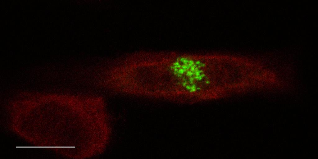 Summary of the Results 33 Figure 4. Immunofluorescence image of NAM and the Golgi in HeLa-NAM cells. Overlay of images shows NAM (red) and the Golgi galactosyltransferase fusion with EGFP (green).