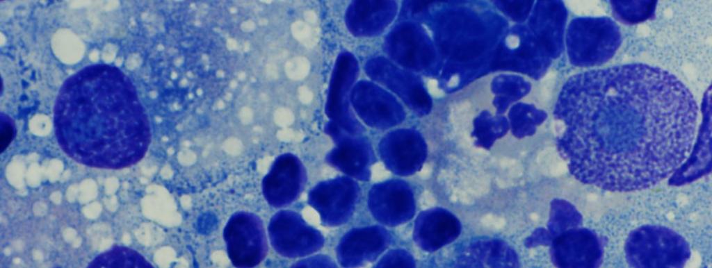 coupled with IHC In the dog Histiocytic Sarcoma is