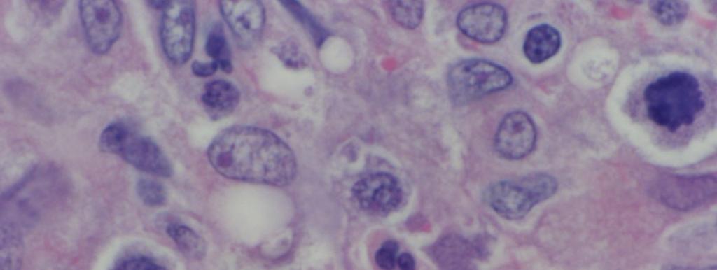 Histiocytosis Dog Skin from Right front limb 13 Detail Histology Canine