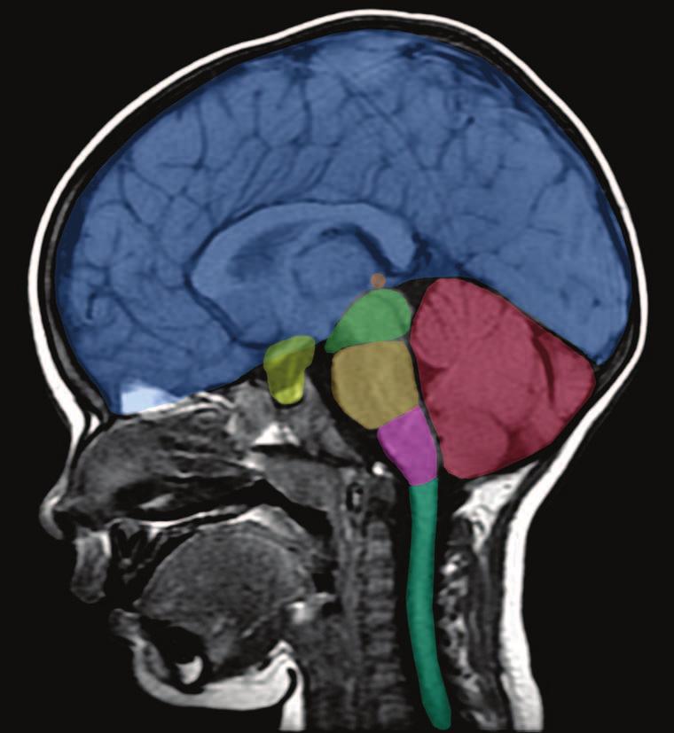 NERVOUS SYSTEM Figure 1.1. Midsagittal magnetic resonance imaging of the brain with regions often associated with particular neuropathological processes.
