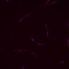 fibroblasts treated with TGFb1 to induce fibrosis