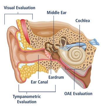 Since hospital-based and private practice pediatricians screen infants and young children for hearing loss and middle ear disorders, incorporating OAEs into this routine testing can be greatly