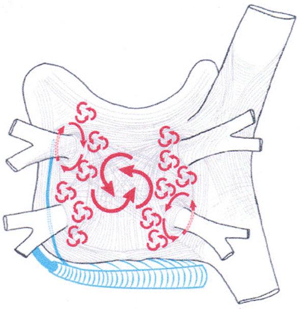 Trigger Sites Posterior view of atria SVC Left superior pulmonary vein Right superior pulmonary vein Left inferior pulmonary vein Coronary Sinus IVC Right inferior