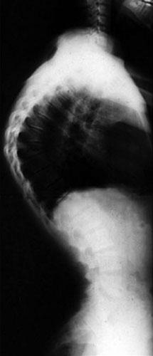 66 A. V é gh et al.: Dentofacial anomalies and scoliosis advance, and their parents provided written consent for participation in the study.