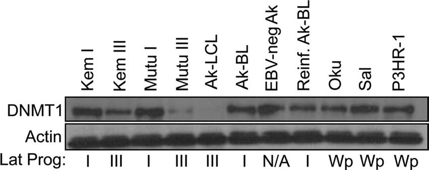 CTCF, DNMT1, and DNMT3B in Restricted EBV Latency FIG 1 DNMT1 expression is elevated during restricted EBV latency.