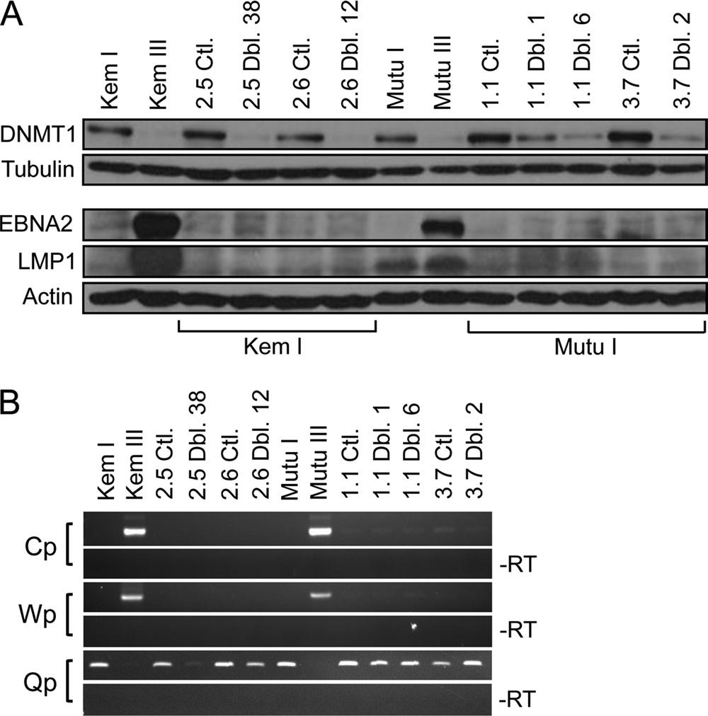 CTCF, DNMT1, and DNMT3B in Restricted EBV Latency FIG 5 Combined knockdown of DNMT1 and DNMT3B does not reactivate latency III-associated mrna and protein expression.