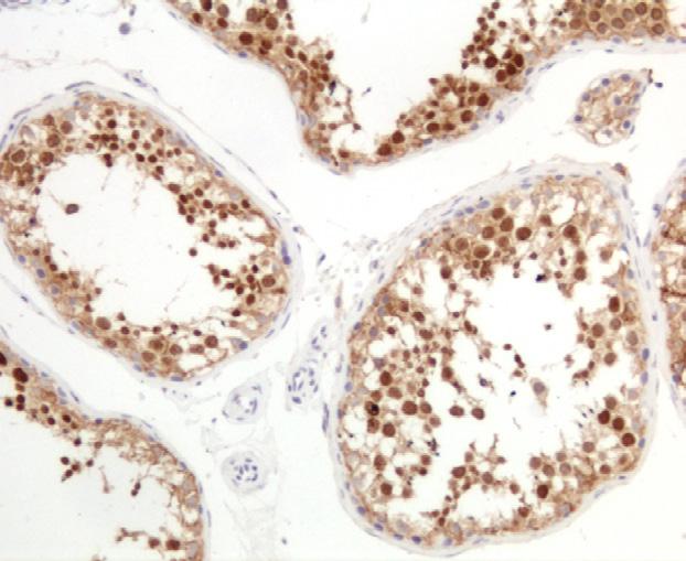 HE4 was detected in bronchiolar, endocervical, endometrial, vas deferens, and breast epithelium by immunohistochemical staining. Distal convoluted tubules in the kidneys were also immunoreactive.