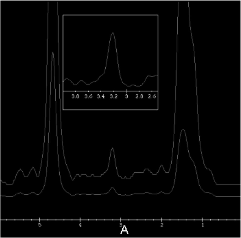 Fig. 5: Sequence of proton spectroscopy demonstrates