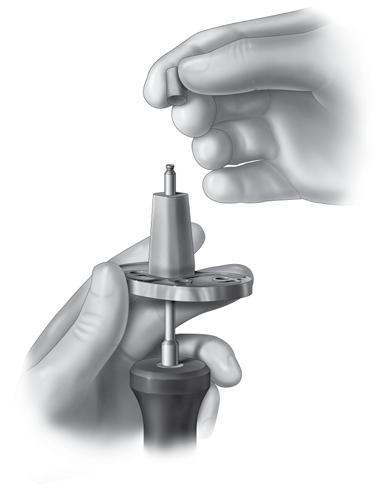 The caps should be retained so that they may be replaced over the screw heads after the augmentation blocks have been attached or the bone screws implanted (Figure 43).