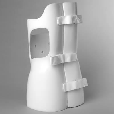 Back Brace, Scoliosis Orthosis, Boston Back Brace Purpose of the Device Provides corrective forces to the thoraco-lumbar spine Incorporates abdominal intercavity pressure to reduce lumbar lordosis