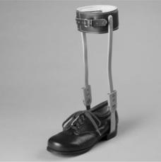 AFO, Ankle Foot Orthosis, Metal Purpose of the Device Provides support to ankle and controls motion of the ankle joint Medial/lateral instability Paralysis Drop foot CVA Common Additions Extra-depth