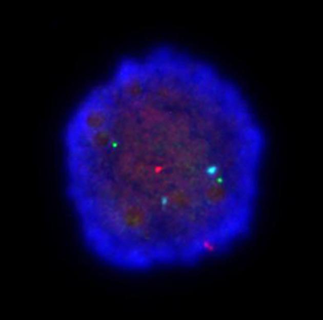 FIGURE 2 Karyotype of the mother [46,XX, t(11;22)(q23;q11.2)]. FIGURE 3 Fluorescent in situ hybridization image of embryo with normal/ balanced signal.