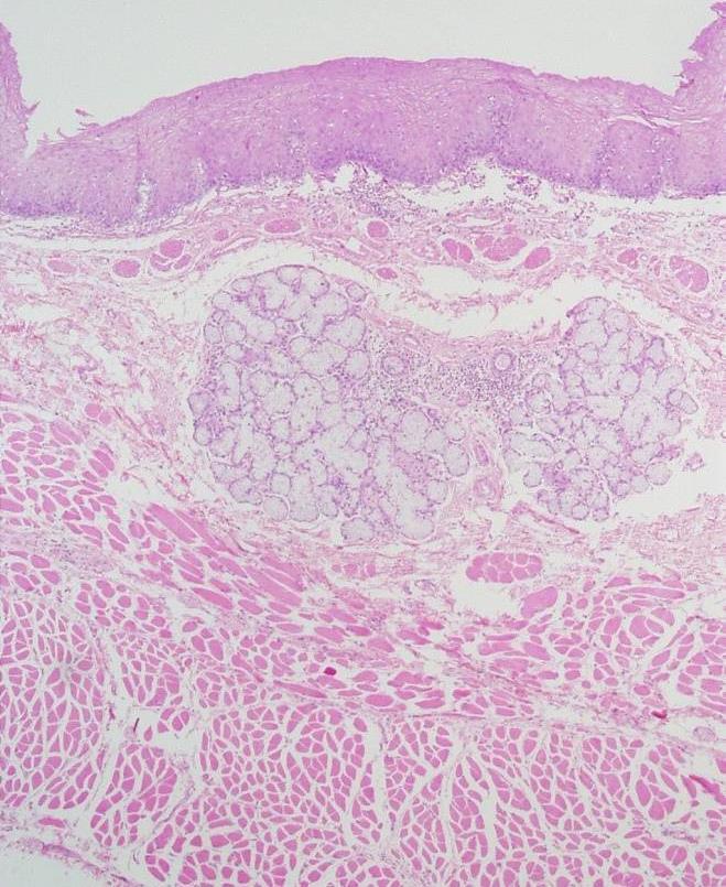 Esophagus 2. Submucosa: Loose areolar C.T. containing blood vessels, nerves, submucosal esophageal glands (secretion of mucus) & Meissner s plexus of nerve fibers and nerve cells. 3.