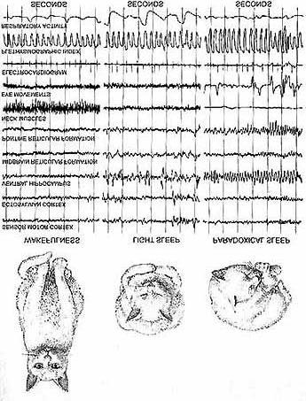 EEG Waveforms During Sleep Synchrony Source: