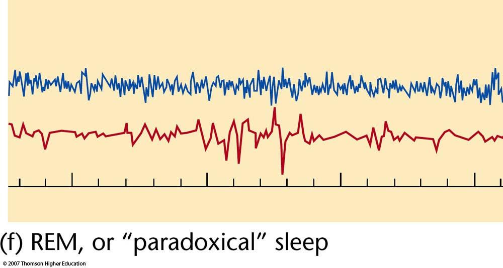Rapid eye movement sleep (REM): periods of sleep with rapid eye movements.