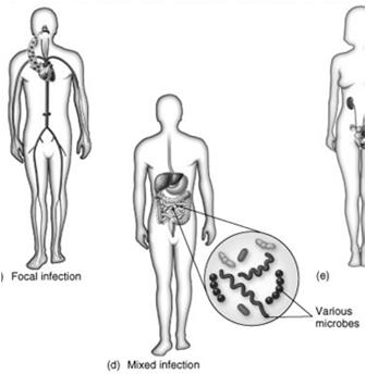Establishment of Infections Focal infection: A bacterial infection localized in a specific part of the body, that spreads to