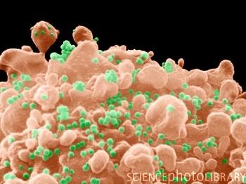 White blood cell HIV In HIV sufferers white blood cells are infected