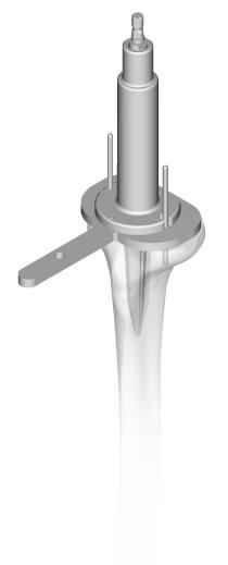 Check the alignment of the tibial cut with the Axial Alignment Rod through the handle of the Baseplate Sizer/ Reamer Guide (Fig. 102).