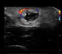 is as clear as the images it offers an ultrasound