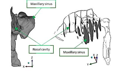 data to software ICEM CFD (by ANSYS inc.) to generate the mesh before the airflow is simulated by FLUENT 14.5 (by ANSYS inc.). A few types of human nasal models with and without the presence of maxillary sinus on the variation of number, position and diameter of ostia (volume: 20.