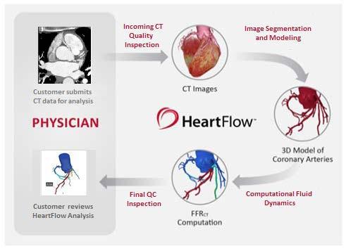 Indirect application HeartFlow FFR CT Personalized 3D flow model of the coronary arteries Impact of