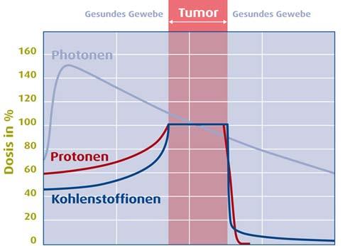 Proton therapy Dose distribution Reduction of dose before the tumour Almost no dose after the tumour thereby: Dose normal tissue/organs at risk Reduction of dose to