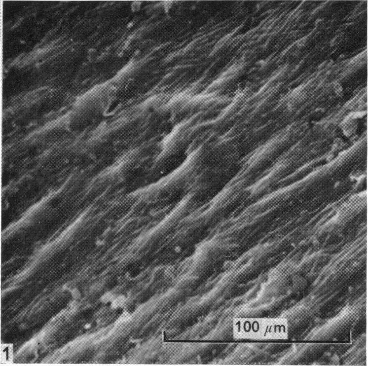 Microstructure of articular cartilage 25 these areas were occupied by apparently shrunken material which may have been derived from