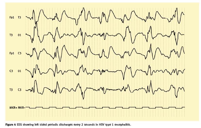 Is the EEG useful?