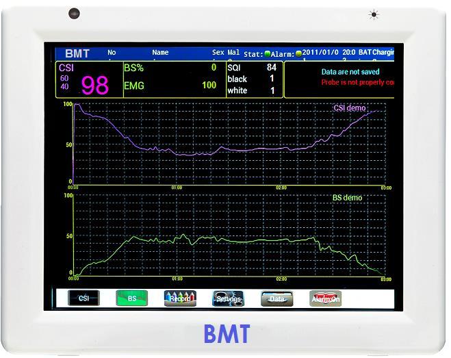 Display BS Percent Ratio time of brain wave under the state of depressed EEG signal in past 30 seconds EMG Electromyography Index.