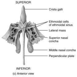 Sphenoid bone (right) With the exception of the ethmoid sinuses, the other paranasal sinuses are paired They are lined with mucus