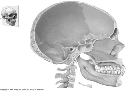 Ex. 7F Ethmoid Bone Located in the anterior part of the cranial floor medial to the orbits and is sponge-like in appearance Ex.