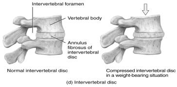 provide strength, support, and balance Various conditions may exaggerate the normal spinal curves, sometimes causing severe disability Intervertebral Discs A tough fibrocartilage