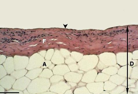 layer between epidermis en dermis; F: fibroblasts and connective tissue; A: adipose tissue within the dermis. Bar: 50µm.