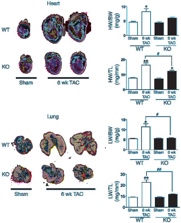 Figure 5 CaMKIIδ deletion reduces relative HW and lung edema in response to 6-week TAC. HW and LW were normalized to BW and TL. Data are mean ± SEM of values from 3 9 mice. *P < 0.05, **P < 0.