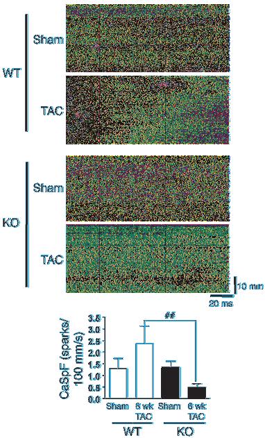 Figure 8 CaMKIIδ ablation reduces SR Ca 2+ leak in 6-week TAC mice. Longitudinal line scan images of spontaneous Ca 2+ sparks were recorded in myocytes from both genotypes with or without TAC.