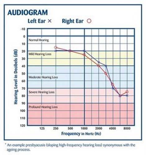 Distortion Component Audiological Evaluation