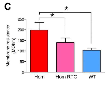 In vitro: Retigabine reverses the neuronal deficit Reduces input resistance in