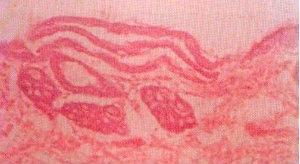 follicles, few blood vessels in the dermis. Fig.